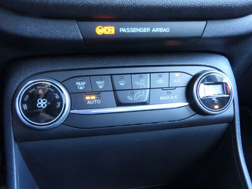Ford Fiesta 1.0 EcoBoost Titanium | Lichtmetalen Velgen | CarPlay/Android Auto | Parkeersensoren | Cruise Con... ActivLease financial lease