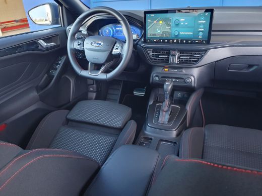 Ford Focus 1.0 ST Line X 155 PK | Winter Pack | 18 inch | Apple Carplay/Android Auto|telefoonintegratie prem... ActivLease financial lease