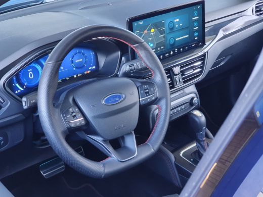 Ford Focus 1.0 ST Line X 155 PK | Winter Pack | 18 inch | Apple Carplay/Android Auto|telefoonintegratie prem... ActivLease financial lease