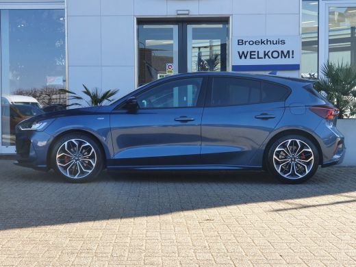 Ford Focus 1.0 ST Line X 155 PK | Winter Pack | 18 inch | Apple Carplay/Android Auto|telefoonintegratie prem... ActivLease financial lease