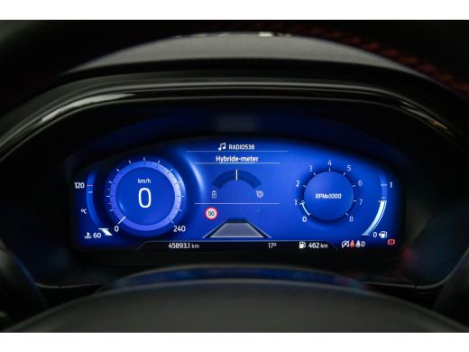 Ford Focus 1.0 EcoBoost Hybrid ST Line X | 155pk! | Achteruitrijcamera | Apple Carplay/Android Auto|telefoon... ActivLease financial lease