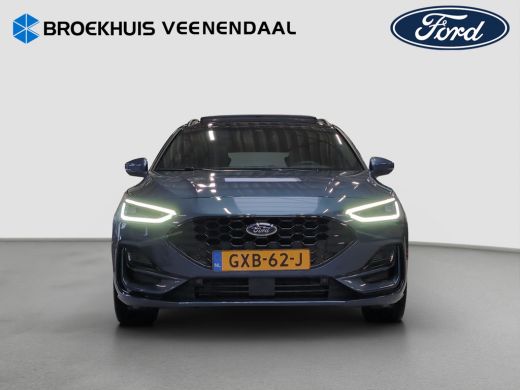 Ford Focus 1.0 EcoBoost Hybrid ST Line X | Achteruitrijcamera | Apple Carplay/Android Auto|telefoonintegrati... ActivLease financial lease