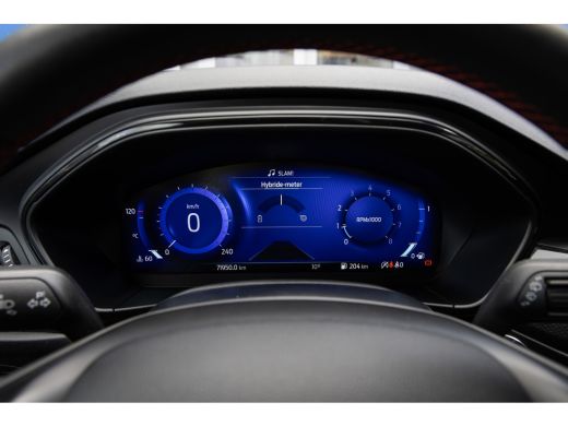 Ford Focus 1.0 EcoBoost Hybrid ST Line X Business | Trekhaak | Camera | Stoel/stuur/voorruit verwarming | Ap... ActivLease financial lease