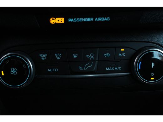 Ford Fiesta 1.0 Titanium | Camera | Navi | PDC V+A | DAB | Cruise | LED | Carplay | Climate | Camera | Navi |... ActivLease financial lease