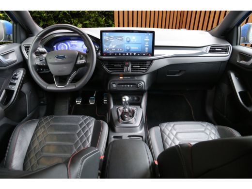 Ford Focus 1.0 EcoBoost Hybrid ST Line X | B&O | Lederen bekleding | Adapt. Cruise | Stoel-stuurverw. | Blis... ActivLease financial lease