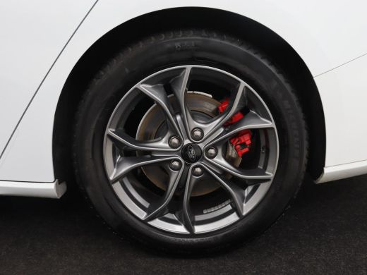 Ford Focus 1.5 EcoBoost ST Line X | Trekhaak | Adaptive cruise | Camera | Carplay | Digital Cockpit | Keyles... ActivLease financial lease