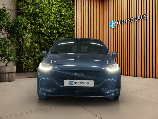Ford Fiesta 1.0 EcoBoost Hybrid ST-Line X | Camera | B&O | Stuur/stoelverwarming | Navi | Clima ActivLease financial lease