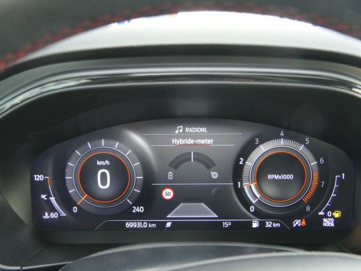 Ford Focus 1.0 EcoBoost 155pk Hybrid ST Line X | Adaptive Cruise | Winterpack | LED | DAB | Camera | CarPlay... ActivLease financial lease