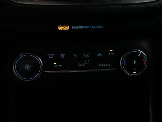 Ford Fiesta 1.0 EcoBoost Hybrid ST-Line | Camera | Adaptive Cruise | 17" Velgen ActivLease financial lease