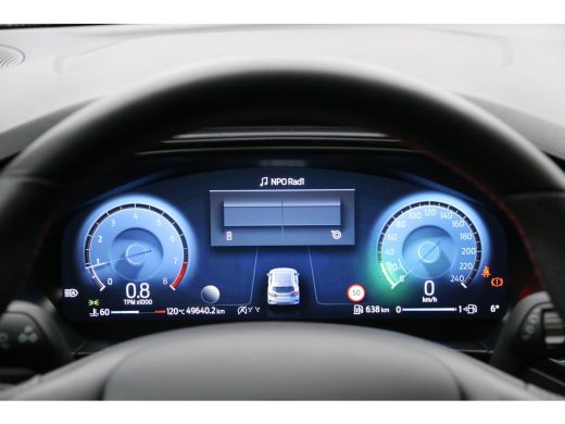 Ford Focus 1.0 EcoBoost Hybrid ST Line X | Navi | Adapt. Cruise | B&O | Stuur/stoelverw. | Pano | 18'' ActivLease financial lease