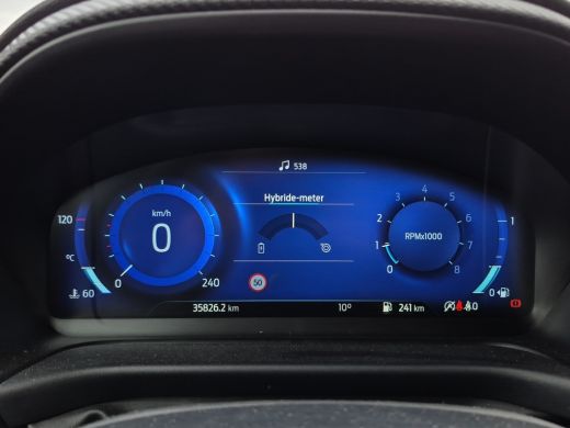 Ford Puma 1.0 EcoBoost Hybrid ST-Line X Full LED | Parkeersensoren | Full map navigatie | Carplay/android a... ActivLease financial lease