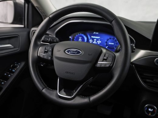 Ford Focus 1.0 EcoBoost Titanium X Sport Automaat (APPLE CARPLAY, GROOT NAVI, CAMERA, STUUR/STOELVERWARMING,... ActivLease financial lease